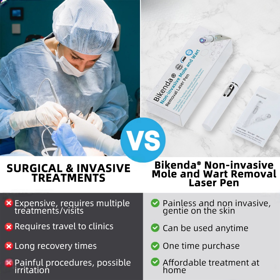 Vermoila® Nicht-invasive Laser-Stift Promax zur Entfernung von Muttermalen und Warzen