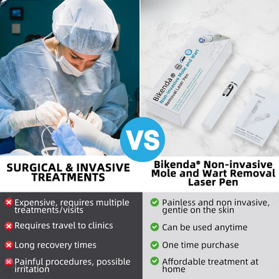 Vermoila® Nicht-invasive Laser-Stift Promax zur Entfernung von Muttermalen und Warzen