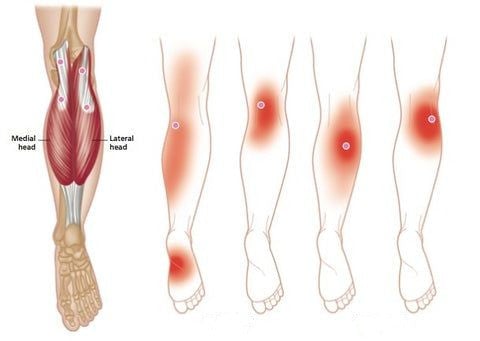 Selbstheizende Kniebandage: Schnelle Schmerzlinderung