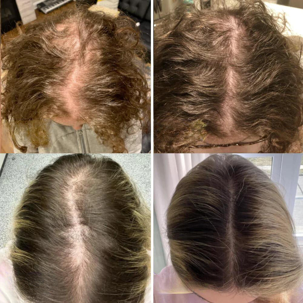 Dein natürliches Haarwuchs-Öl – Minopia