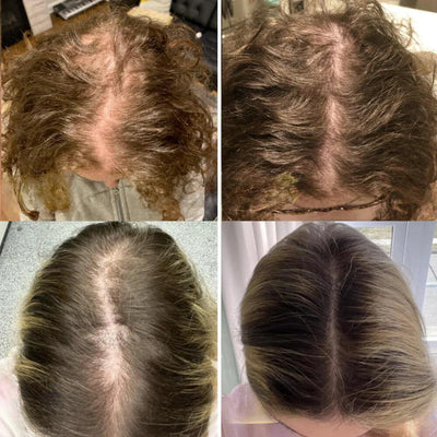 Dein natürliches Haarwuchs-Öl – Minopia
