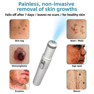 Vermoila® Nicht-invasive Laser-Stift Promax zur Entfernung von Muttermalen und Warzen