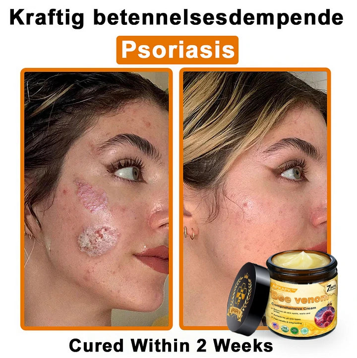 APK Bienengift-Komplexcreme🐝✨