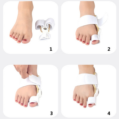 Korrekturorthese für Hallux Valgus mit Gelenk – KAUFE 1, ERHALTE 2