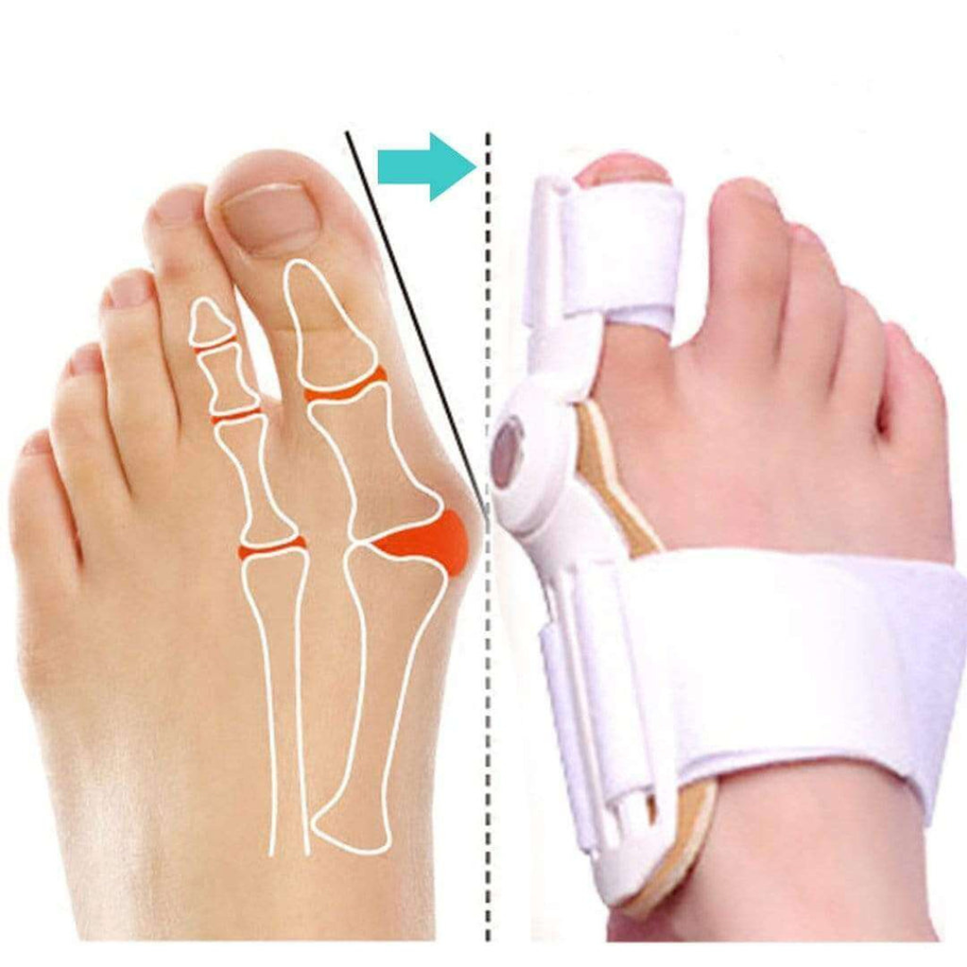 Korrigierender Orthopädischer Hallux Valgus-Schiene – KAUFE 1, ERHALTE 2