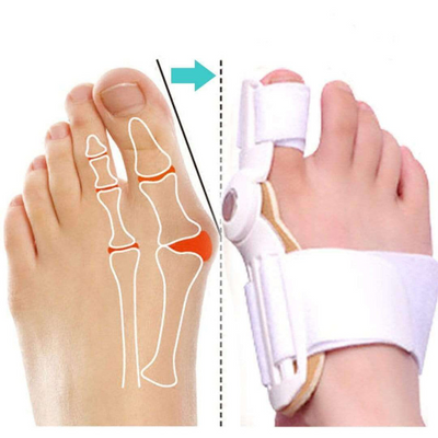 Korrekturorthese für Hallux Valgus mit Gelenk – KAUFE 1, ERHALTE 2