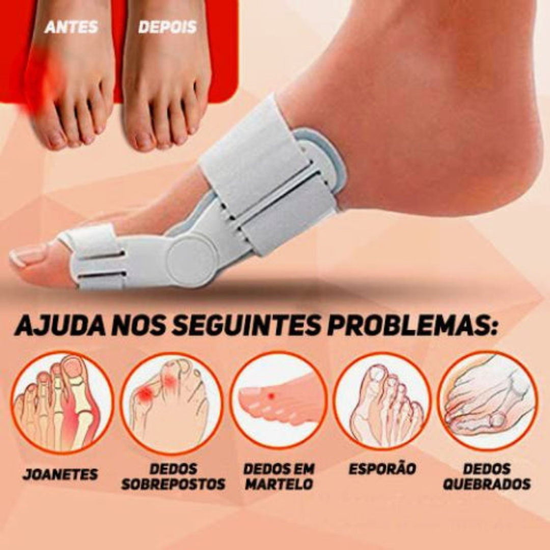 Korrekturorthese für Hallux Valgus mit Gelenk – KAUFE 1, ERHALTE 2