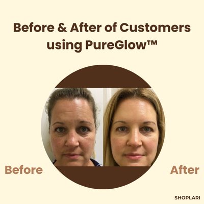 Letzter Tag – 1+1 GRATIS!🔥 PureGlow™ Schwarztee-Maske