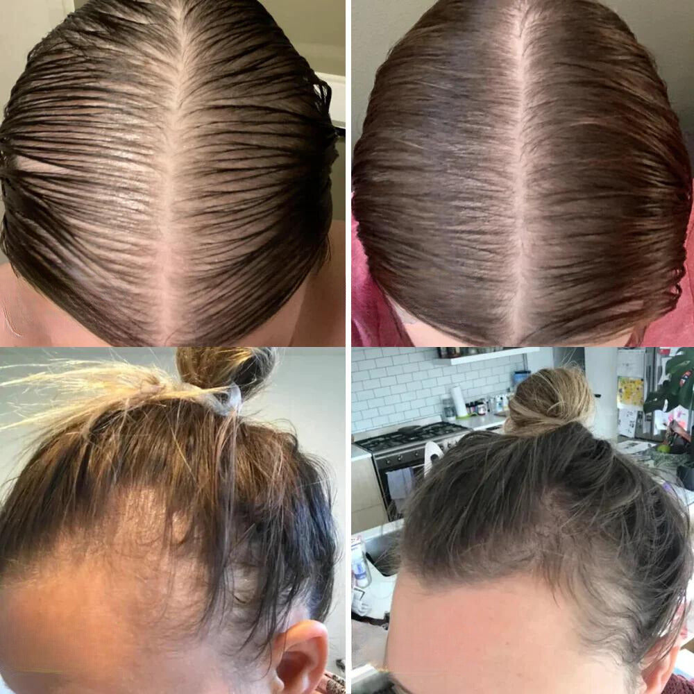 Dein natürliches Haarwuchs-Öl – Minopia